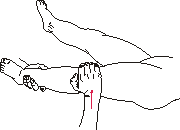 рис.24 (Коррекция коленного сустава)